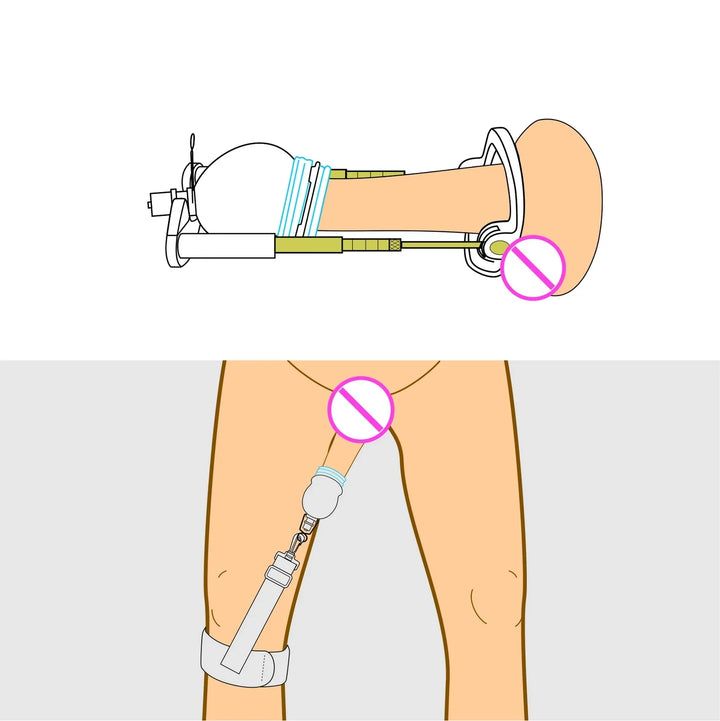 SizeMasterX Rod-Traction + Leg-Strap Penis Extender System