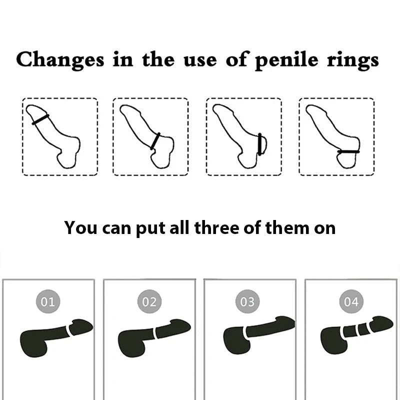 A diagram showing the various orientations and attachment styles of the multi-ridge cock ring on a penis