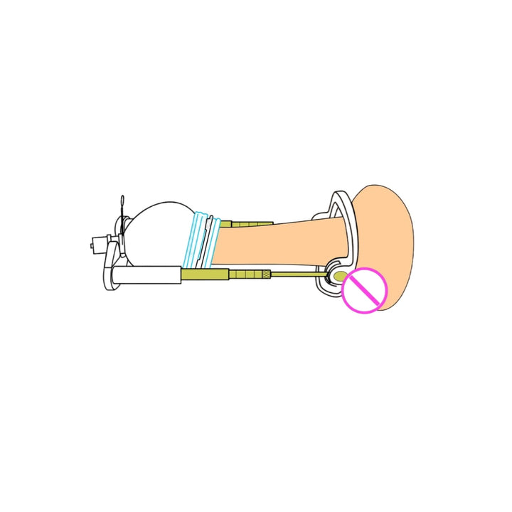 SizeMasterX Rod-Traction + Leg-Strap Penis Extender System