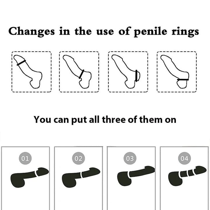 A diagram showing the various orientations and attachment styles of the multi-ridge cock ring on a penis